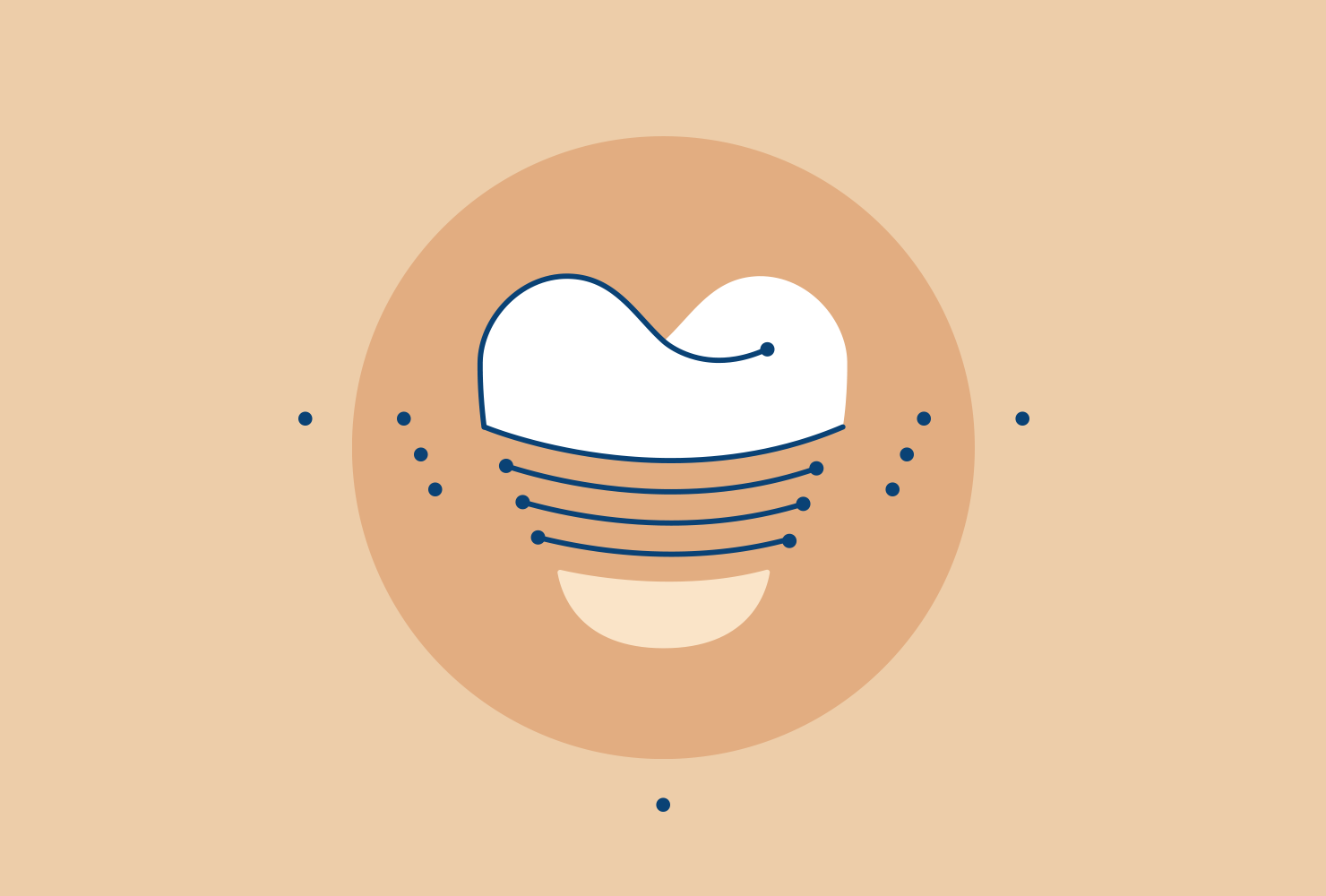 Visual Implantate